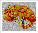 Brain Graphic
