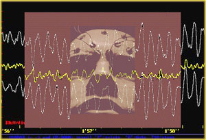 EEG Graphic