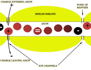 Ion Channels: Damage to Axons